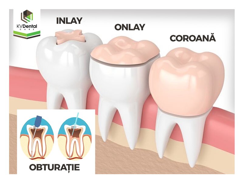 Kvdental - Cabinet Stomatologic